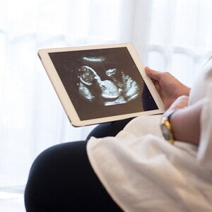 Qué es el embarazo molar, sus causas, los síntomas y más Qué es el embarazo molar, sus causas, los síntomas y más