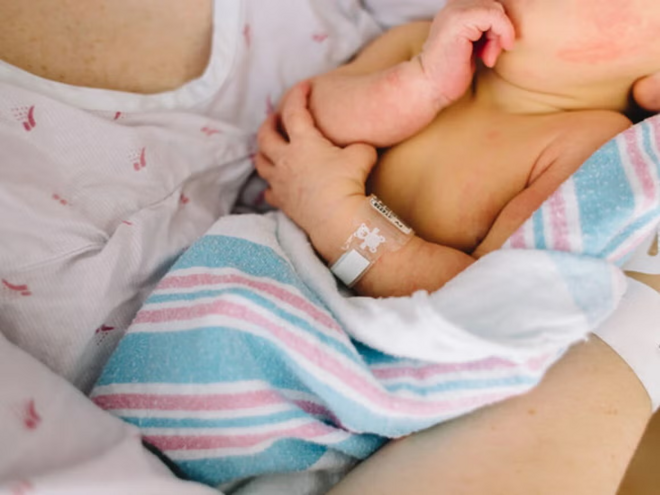 Ictericia Neonatal Mamá sosteniendo a un bebé recién nacido con ictericia neonatal.