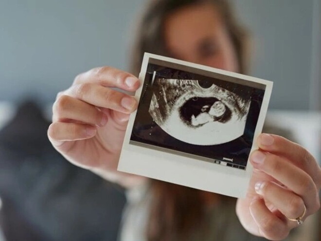 Crecimiento fetal: Mes a mes Desarrollo del feto: Mes a mes