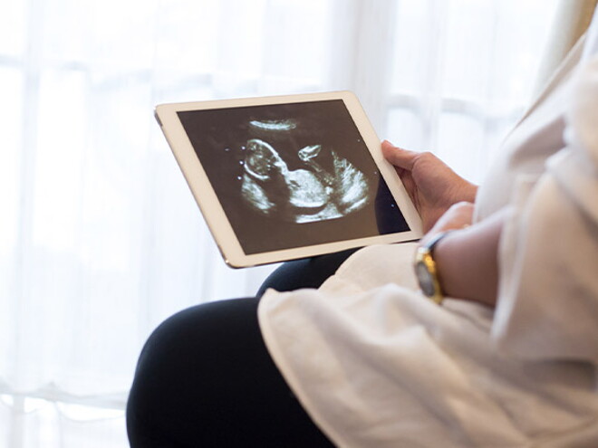 Qué es el embarazo molar, sus causas, los síntomas y más Qué es el embarazo molar, sus causas, los síntomas y más