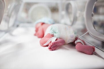 Bebe prematuro Bebe prematuro